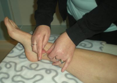 Acupuncture